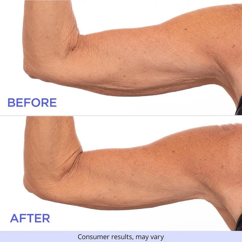 2. Real, Visible Firming Where It Matters Most